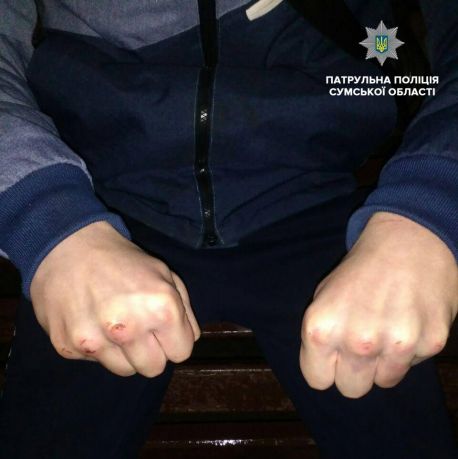 На 8 березня 16-річний сумчанин зґвалтував жінку